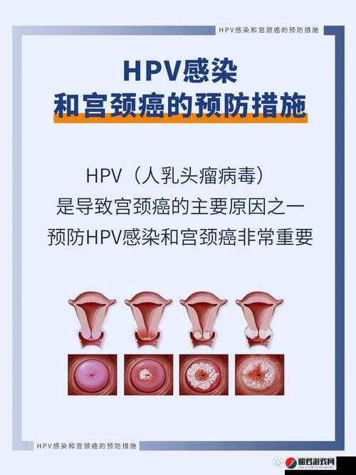 和两个人发生过关系会得HPV吗：关于HPV感染的重要疑问